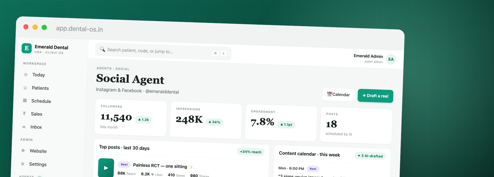Onvertz — posts & updates screen